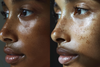 The Glow Up: How Beta-Carotene Benefits Your Skin