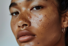 How Cortisol and Stress Hormones Cause Acne and Dull Skin