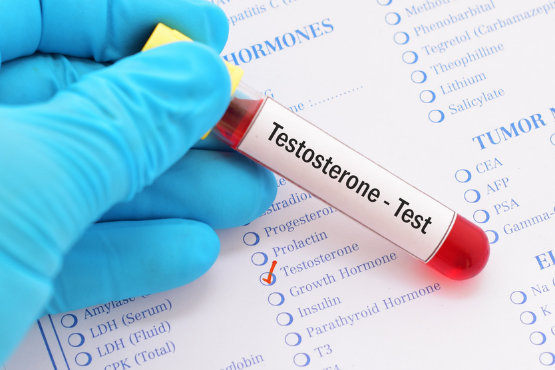 Signs of Low Testosterone and How to Fix It